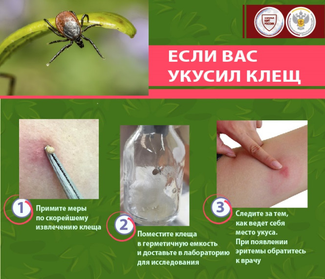 Памятка. Осторожно! Клещи!. Памятка. Осторожно! Клещи!.
